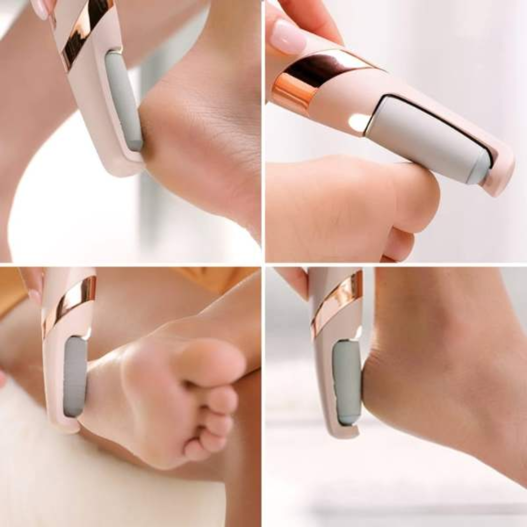 Electric Pedicure Callus Remover